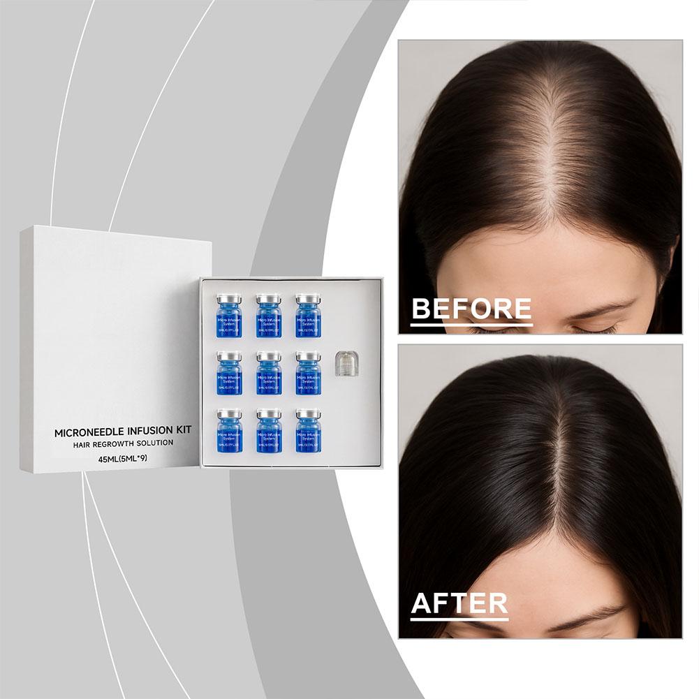 Hair Care Kit - 0.25mm Saç Esansiyel Serumu Mikro iğneli