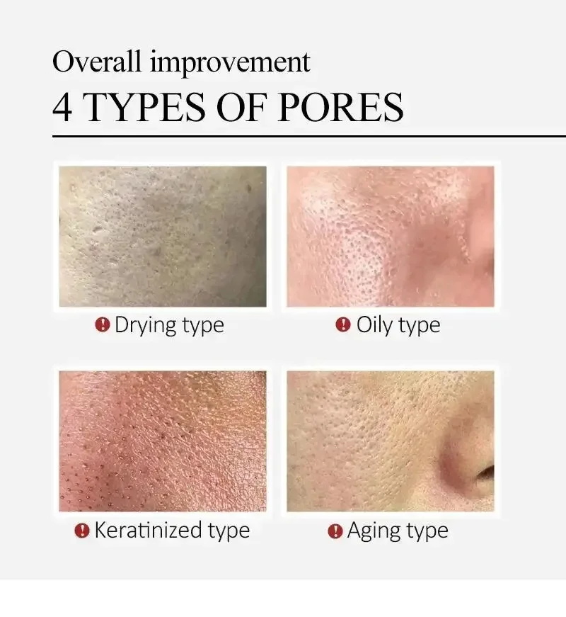 Centella Asiatica Gözenekleri  - Silk Press Serum incelemesi ve fiyatı