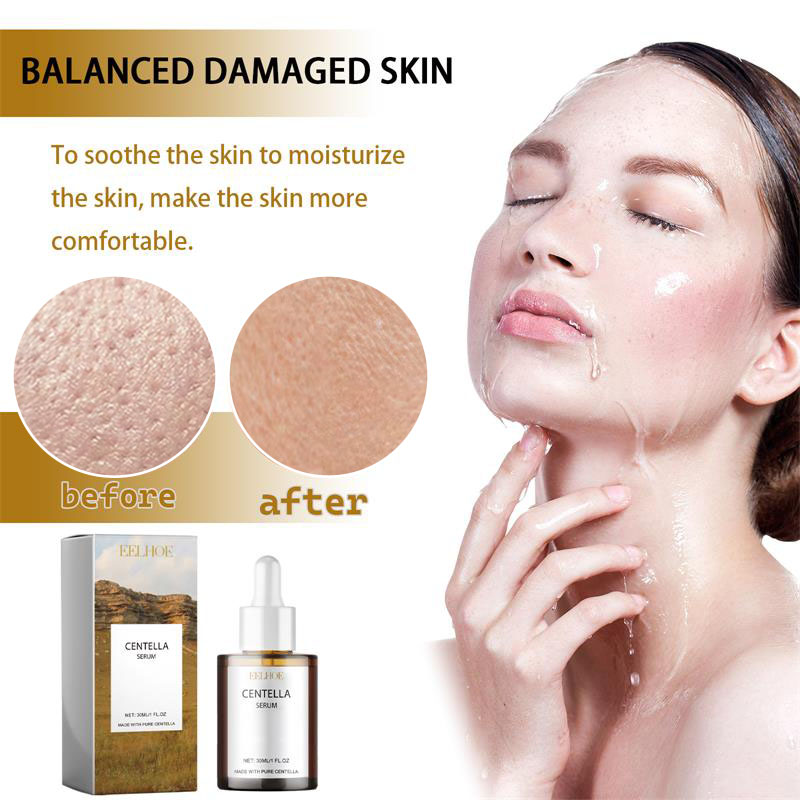 Centella Asiatica Gözenekleri  - Silk Press Serum incelemesi ve fiyatı