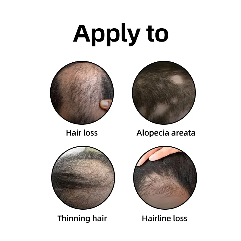Zencefil Hızlı Saç Büyüme Spre - Hair Care Serum incelemesi ve fiyatı