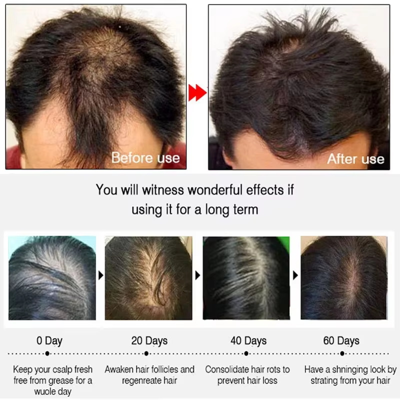 Hızlı Zencefilli Saç Uzatma Sp - Hair Care Tonic incelemesi ve fiyatı