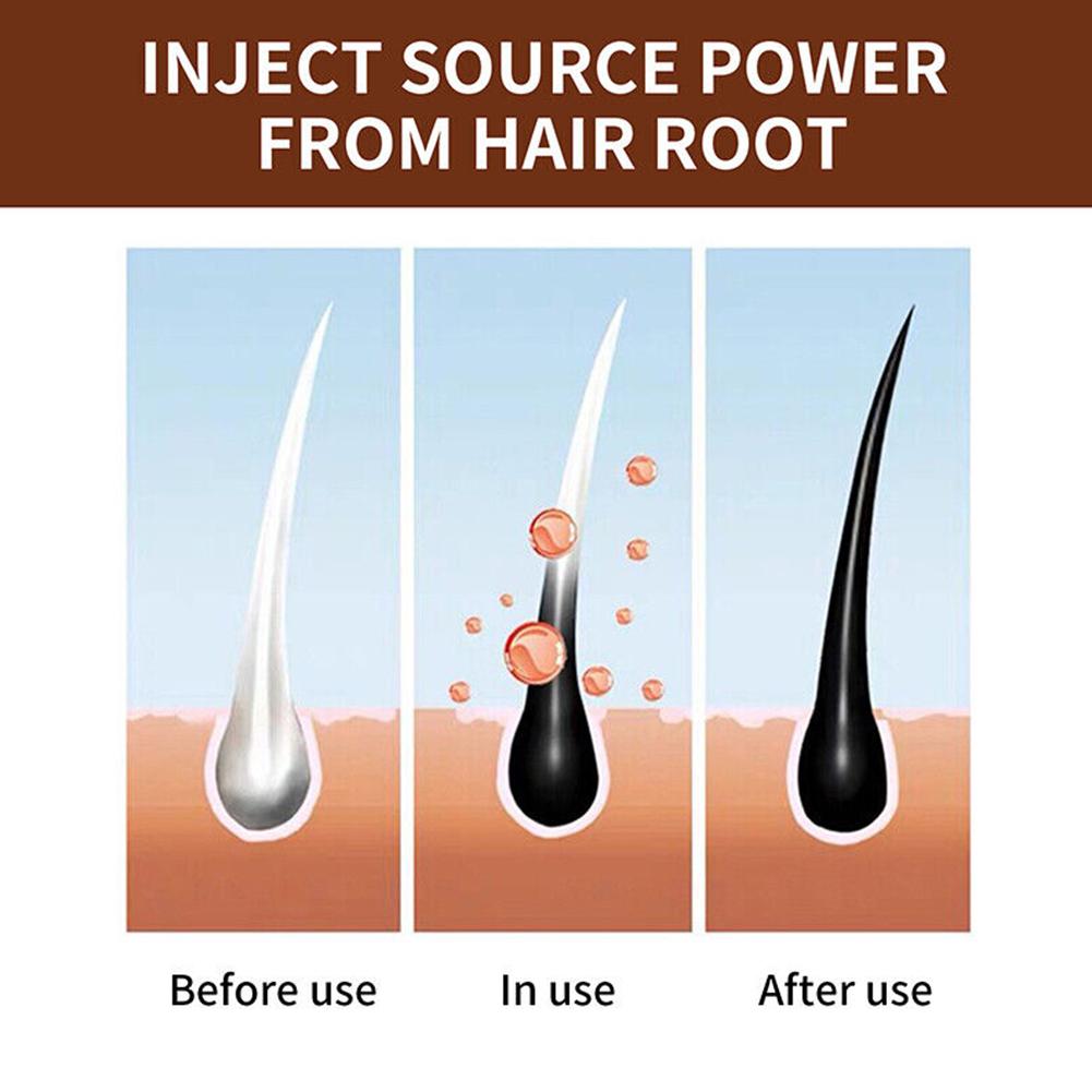 Doğal Polygonum El Yapımı Sabu - Hair Care Tonic incelemesi ve fiyatı